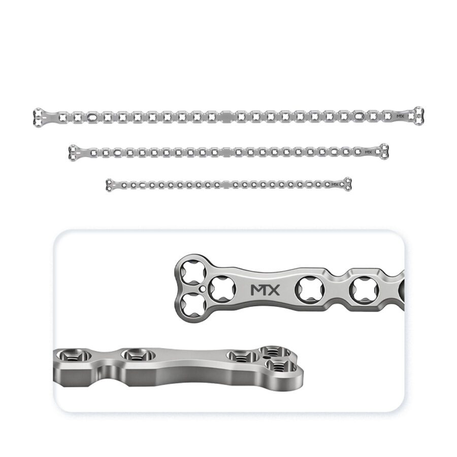 1.5/2.0/2.4mm LOKI Platinum Double T Polyaxial Locking Plate