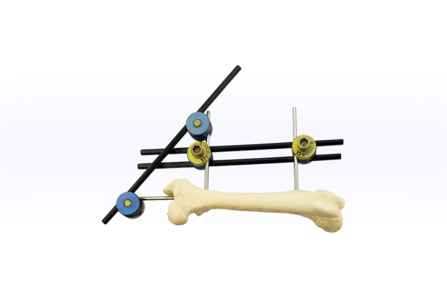 Mini External Fixation System